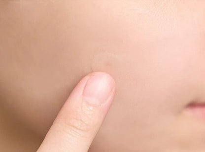 SKIN1004 Madagascar Centella Tea-Trica Spot Cover Patch